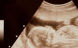 北京私立试管医院排名前十名，2026北京试管婴儿私立医院优秀排名