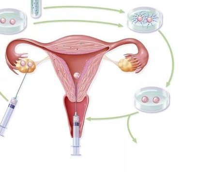 马来西亚试管婴儿费用及医院性价比对比分析